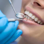 Dentiste en zone sous-dotée : comment se faire soigner malgré tout ?