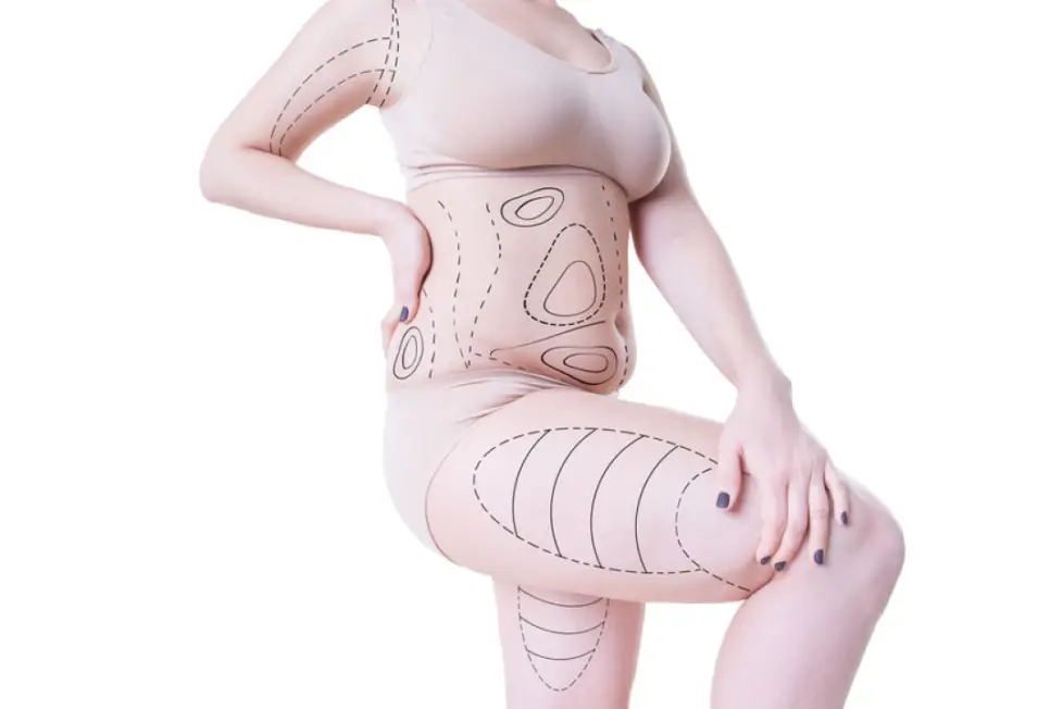 Comment perdre du poids grâce à la liposuccion VASER ?